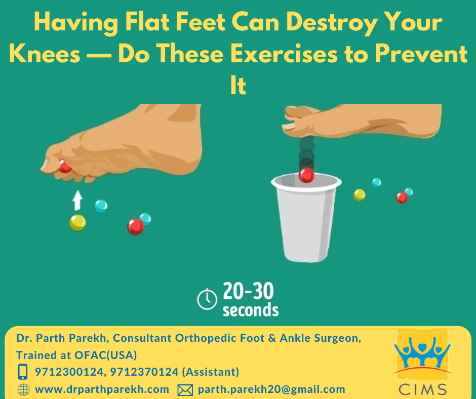 It is just Flat Foot! What to worry about? - Dr. Parth Parekh