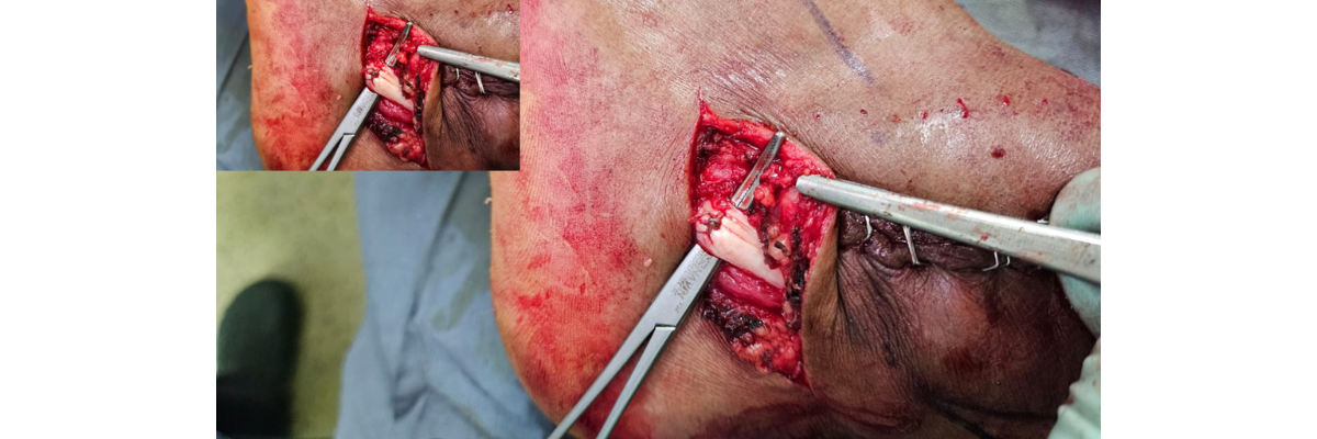 Kirtan Desai (Australia) 28 - Dr. Parth Parekh