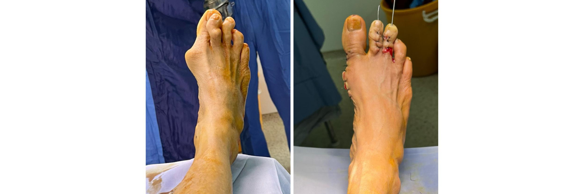 Anjana Sharma (Delhi) 75year - Dr. Parth Parekh