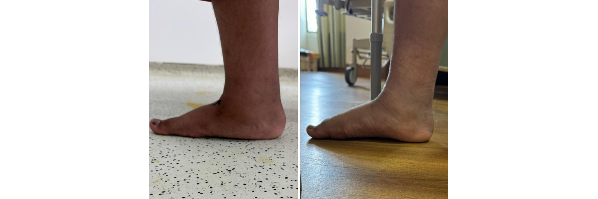 Vaibhav Jain (Jaipur)  49year - Dr. Parth Parekh