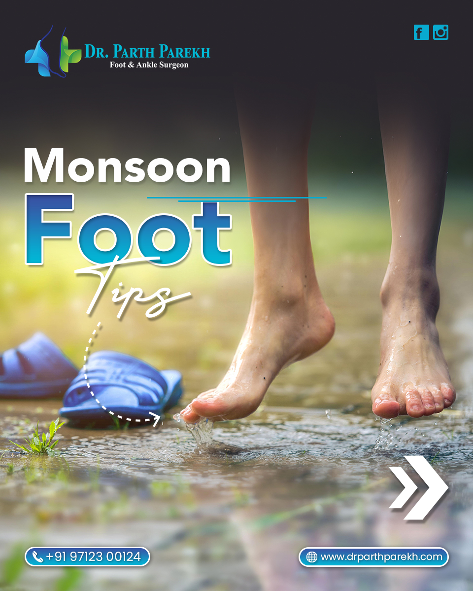 Don't let these beautiful monsoon showers dampen your spirits, or your feet!